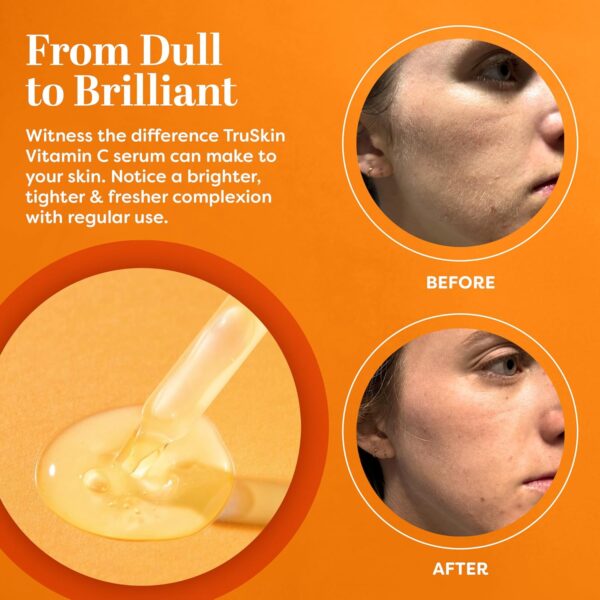 TruSkin Vitamin C Serum – Anti Aging Facial Serum with Vitamin C, Hyaluronic Acid
