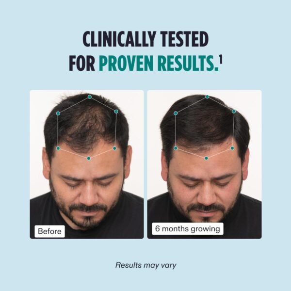 Nutrafol Men's Hair Growth Supplements